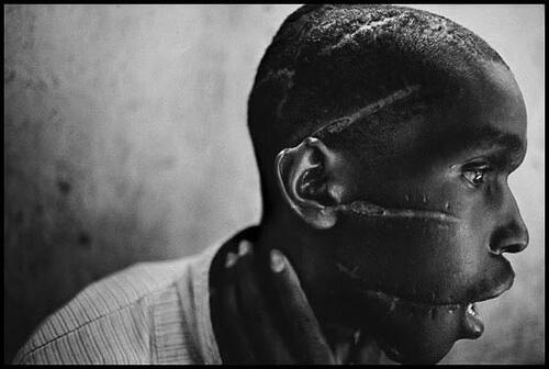 Superviviente campo hutu, Ruanda 1994